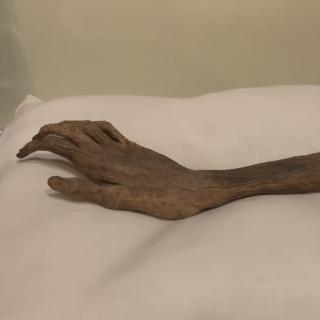 A mummified arm sits on a white pillow in a museum display case. At a close angle, you can see the indents of fingernails. 