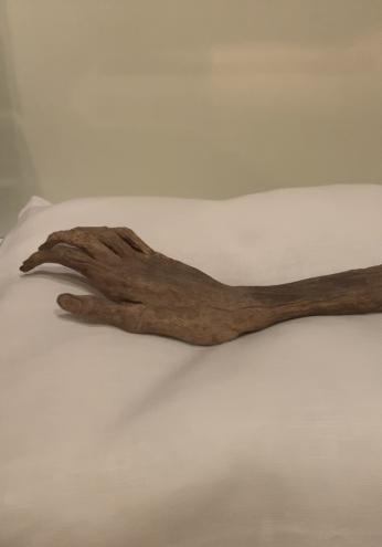 A mummified arm sits on a white pillow in a museum display case. At a close angle, you can see the indents of fingernails. 