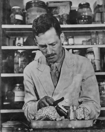 Dr. Webb Haymaker with the brain of Nazi henchman Robert Ley, studied shortly after Mussolini's. (Photo source: Wikimedia Commons)