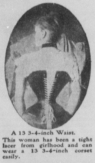 Tightly laced corset. (Photo source: The Washington Herald, June 27, 1909)